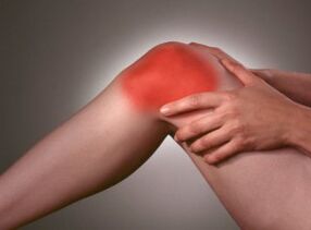D'Symptom vun Arthrosis ass schwéier Schmerz am Knéiberäich