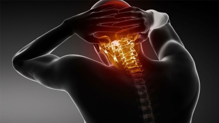 Péng am Réck vum Kapp mat cervical osteochondrosis